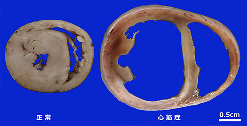 病理学部門:ミーアキャットの心筋症